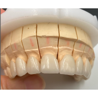 Zirconia Ceramics - Zirconia Ceramics OEM