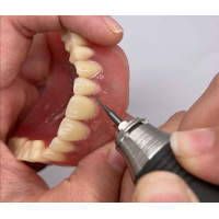 Crown Bridge Zirconia China Dental