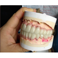 Crown Bridge Zirconia China Dental Lab