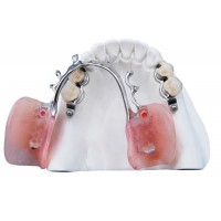 Pfm Bridge -- China Dental Lab Dental Crown in Good Quality and Good Esthetics