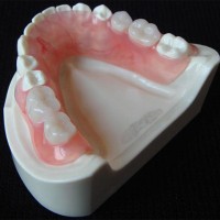 Zirconia Crowns - China Dental Lab Dental Crowns in Good Quality and Good Esthetics