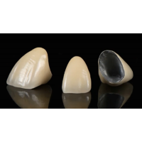 Layered Zirconia Crown - China Dental Lab Dental Crown in Good Quality, Good Fitting and Good Esthetics