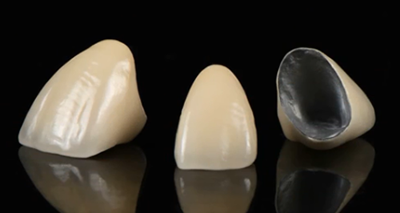 Crown Bridge Zirconia China Dental